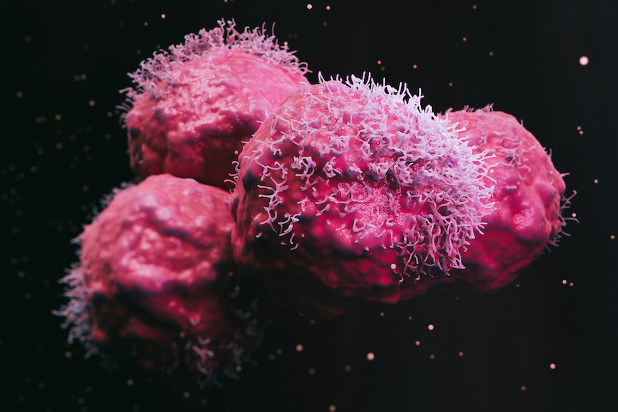 Scanning electron micrograph of four round cancer cells, shown in red.