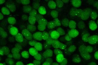 Image of fluorescent green protein molecules