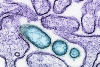 Colorized transmission electron micrograph of mature extracellular Nipah virus particles (teal) near the periphery of an infected VERO cell (purple). 