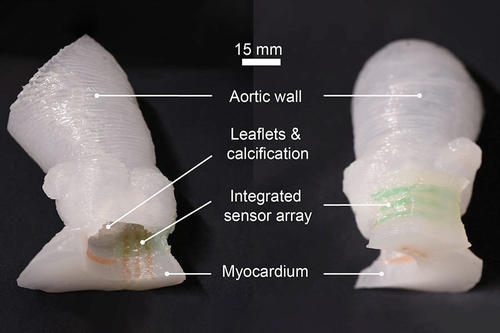 3D printed heart valves