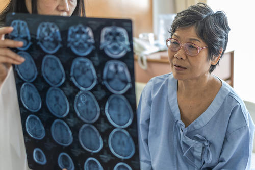 Doctor holding up brain scans for elderly woman to view