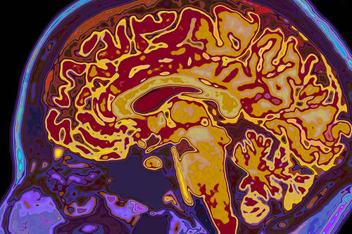 A colorful image of a human brain inside a skull.