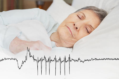 A gray-haired woman sleeps. A graph of EEG activity during a seizure is overlaid.