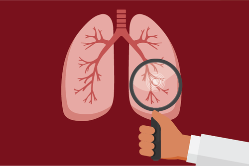 A maroon and gold graphic shows a white-coated arm holding a magnifying glass to a pair of lungs.