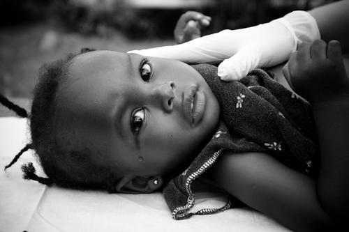 A young black child lies supine and looks at the camera as a gloved hand performs an examination.